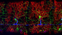 Microtubule Regulator Ringer Promotes Axon Regeneration