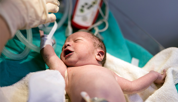 Developing data-driven resuscitation guidelines for newborns with congenital anomalies.